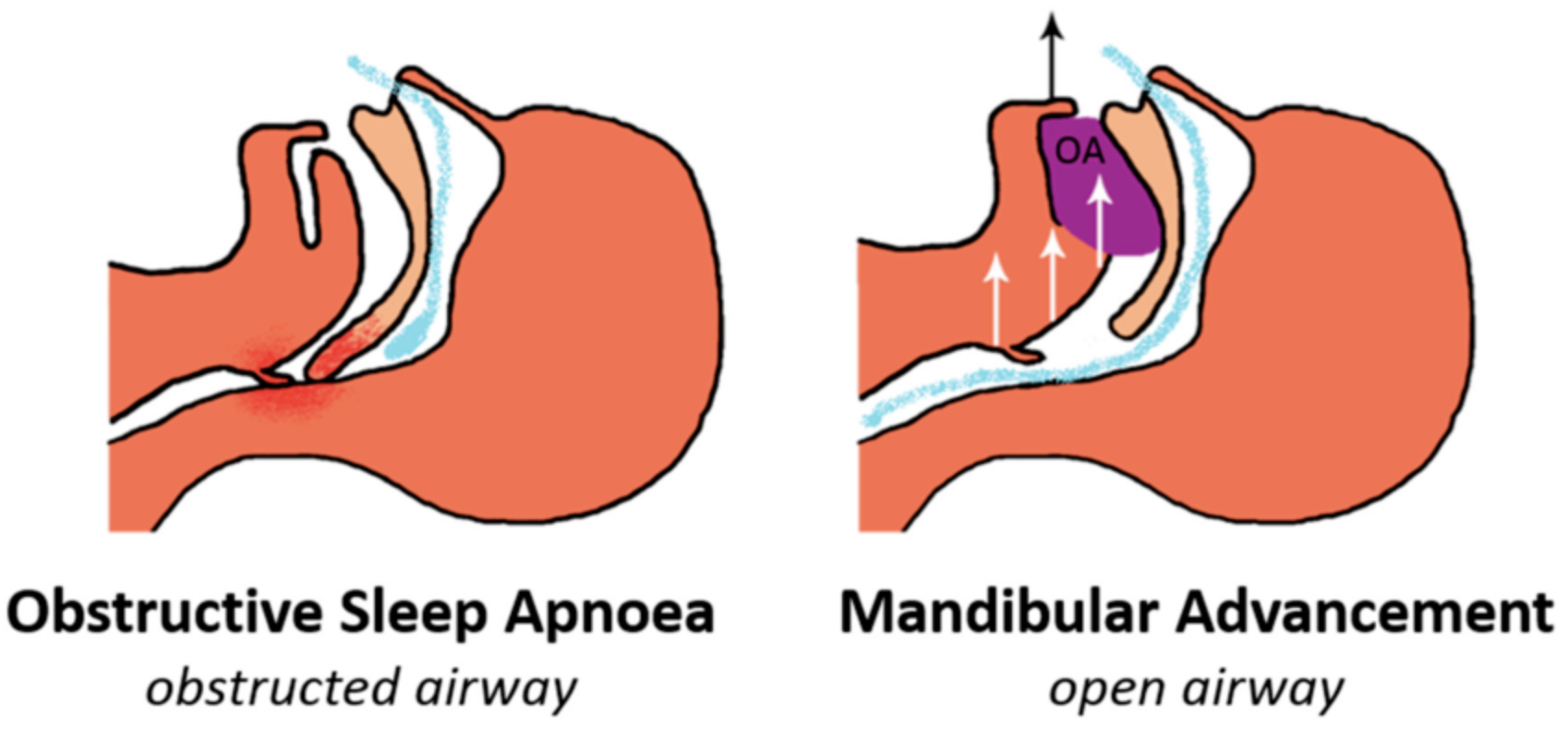 treatment_process_image